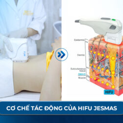 Cách chọn máy hifu phù hợp cho Spa