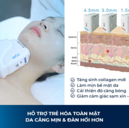 HIFU Làm Tăng Sinh Collagen Như Thế Nào?